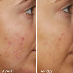 B3 Nice 10% Niacinamide Sérum Rééquilibrant