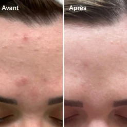 Bl+C Serum Concentré Anti-Imperfections Cumin Noir + Cajeput