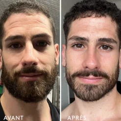 Complément Alimentaire Repulpant