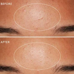 Daily Microfoliant Exfoliant Poudre