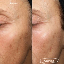 Fade Forward Sérum Anti-Taches