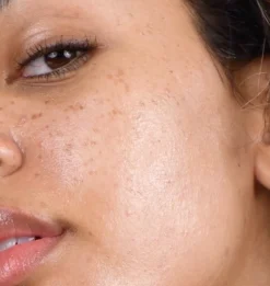 Good Genes All in One Lactic Acid Treatment Sérum Acide Lactique