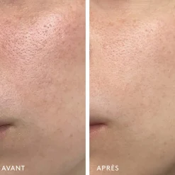 Milky Way Sérum Exfoliant 10% Acide Lactique