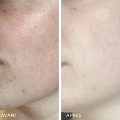 Milky Way Sérum Exfoliant 10% Acide Lactique